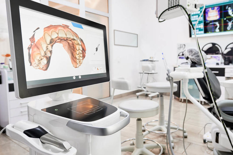 CEREC dental scanner machine in a dental exam room